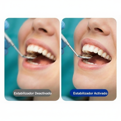 Caméra d’enregistrement pour procédures médicales, dentaires et esthétiques – 4K à 30 FPS